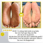 ✨ Rechargeable Electric Foot Callus Remover – 2-Speed Heel Scrubber