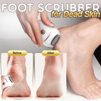 ✨ Rechargeable Electric Foot Callus Remover – 2-Speed Heel Scrubber