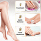 ✨ Rechargeable Electric Foot Callus Remover – 2-Speed Heel Scrubber