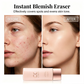 ✨🎨 Flawless concealer cream – hides blemishes, hydrates, lasts all day!