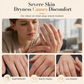 💧👐 Hydrolyzed Collagen Hand Cream – Lightweight Moisture for Dry Skin